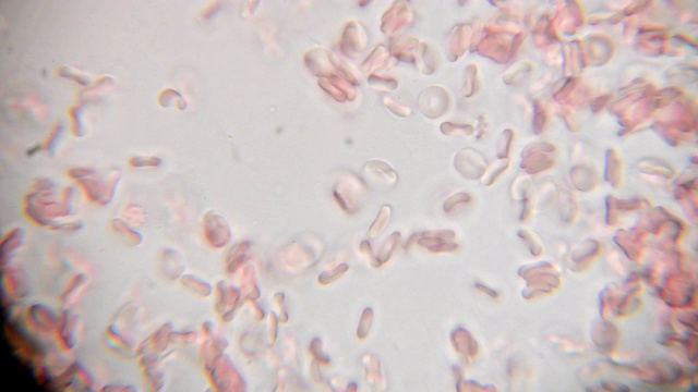 1000倍显微镜下看到的新鲜血液。显微镜下的血液涂片显示血浆、白细胞和红细胞视频素材