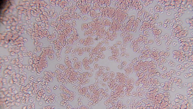 400倍显微镜下看到的新鲜血液。显微镜下的血液涂片显示血浆、白细胞和红细胞视频素材