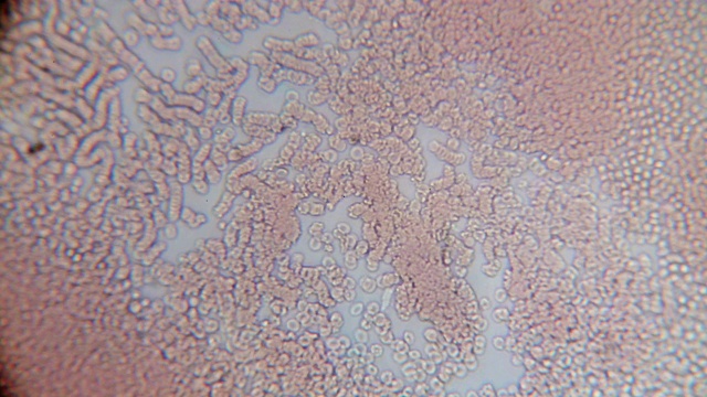 看到400 x。显微镜下的红细胞。运动的物体视频下载