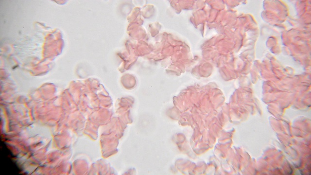 1000倍显微镜下看到的新鲜血液。显微镜下的血液涂片显示血浆、白细胞和红细胞视频下载