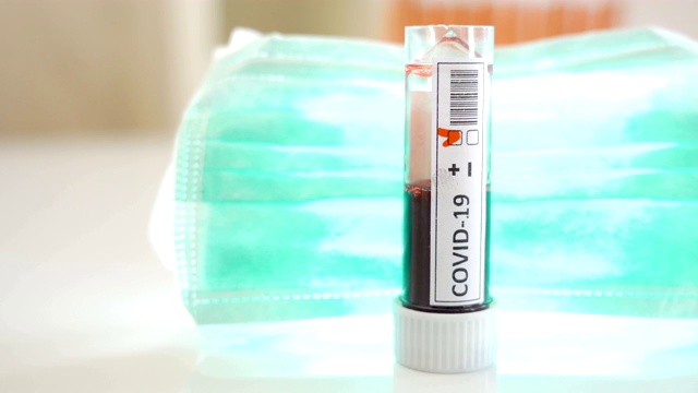 一份Covid-19冠状病毒阳性血液样本视频素材