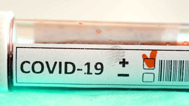 Covid-19冠状病毒阳性标记的进一步观察视频素材
