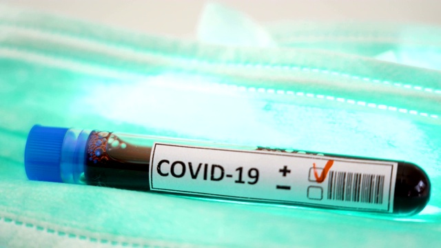 Covid-19或冠状病毒检测样本呈阳性视频素材