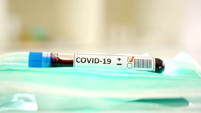 冠状病毒检测呈阳性的蓝帽试管视频素材