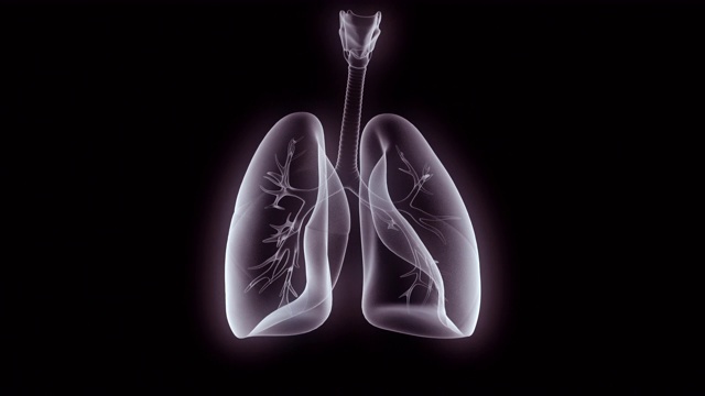 磁共振成像扫描人类的肺视频素材