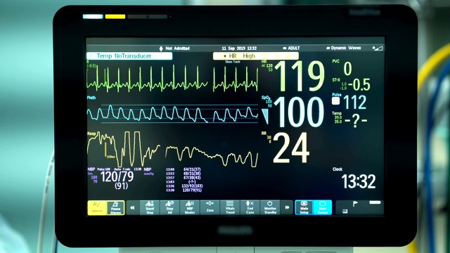 手术室心脏监护仪的关闭。心电监护仪显示患者的心率背景视频下载