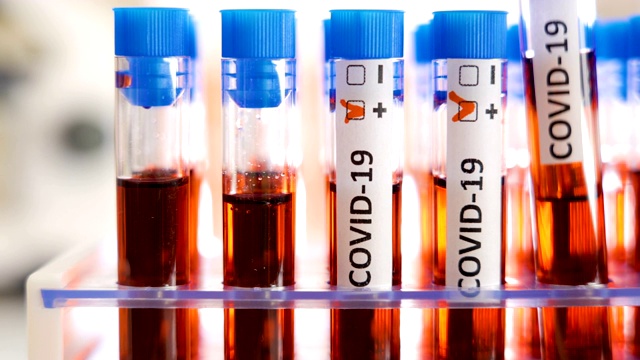 仔细查看COVID-19冠状病毒检测阳性试剂盒视频下载