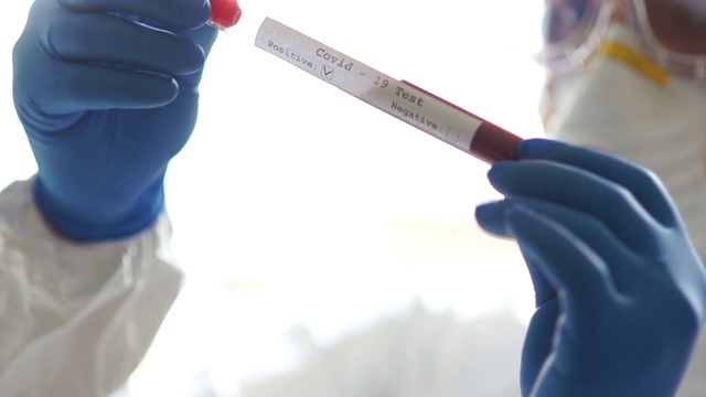 医生的手拿着一个试管，里面有血液样本，用于研究快速传播的新型冠状病毒Covid-19。积极的测试视频素材