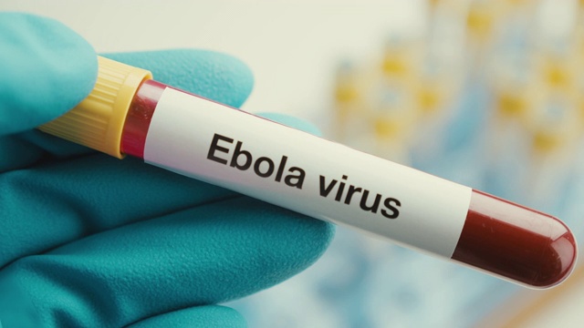 近距离科学家手手套实验室试管保护埃博拉病毒阳性背景视频下载