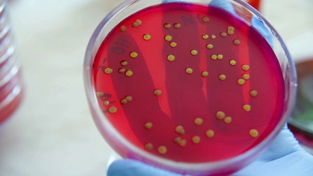 细菌实验室里的培养皿视频下载