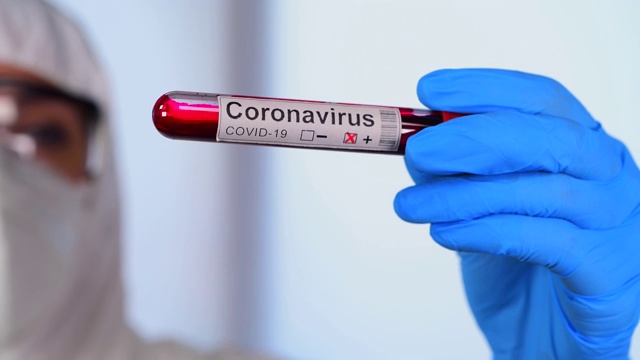 新型冠状病毒暴发疫情检测试剂盒检测冠状病毒COVID - 19医学样本视频素材