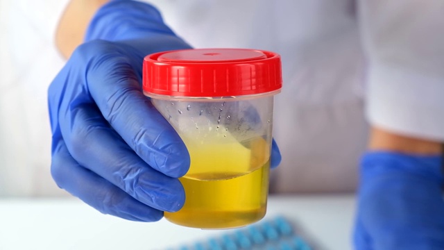 医生或实验室技术员展示装有尿液样本的容器，用于医学实验室、医学尿检和健康扫描分析和研究视频素材