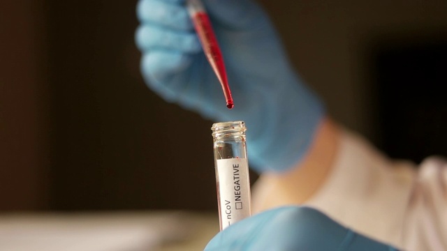 科学家在实验室验血视频素材