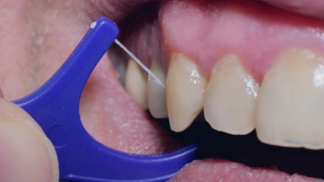 宏牙用牙线清洁牙齿的过程视频下载