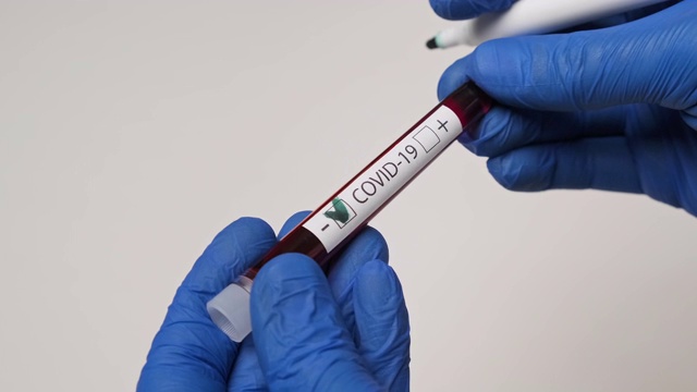COVID-19检测阴性。医务人员拿着检测血样视频素材