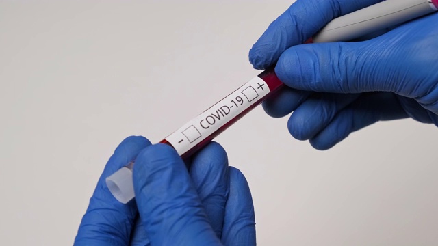 COVID-19检测阳性。医务人员拿着检测血样视频素材