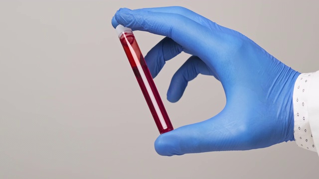 病毒的血液测试。医护人员戴着防护手套拿着带血管视频素材