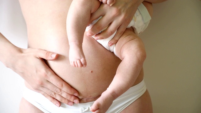 特写的妇女腹部疤痕从剖腹产。手上抱着婴儿的女人视频素材