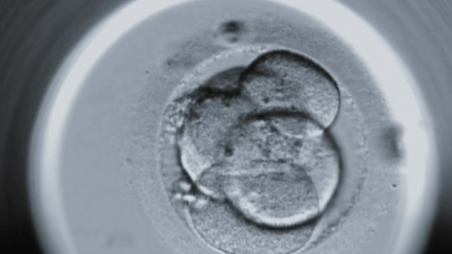 在人类卵细胞中，时间推移细胞分裂视频下载
