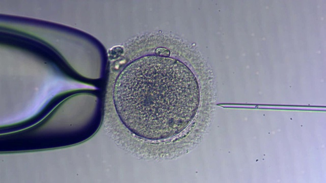 体外受精与精子受精的人类卵子视频下载