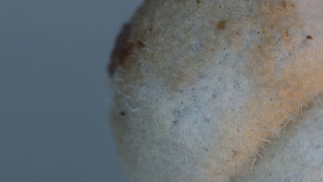 粉蚧假球菌科显微镜下观察视频下载