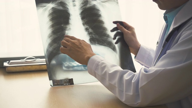 一位亚洲医生正在向病人解释x光胶片上的肺部图像。医生穿着长袍制服和听诊器。医生坐在医院的诊所里。视频下载