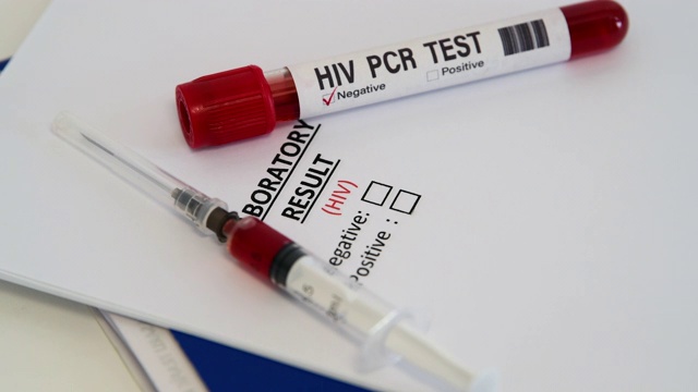 艾滋病病毒测试。艾滋病血液测试视频下载