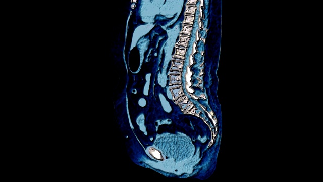 大量彩色MRI显示腹腔，胃肠道，膀胱视频素材
