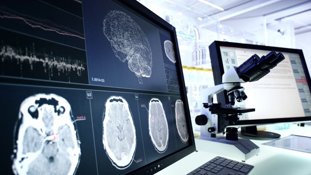 未来的实验室设备。电脑屏幕上的脑电波扫描研究视频素材