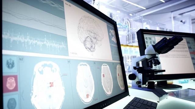 未来的实验室设备。电脑屏幕上的脑电波扫描研究视频素材