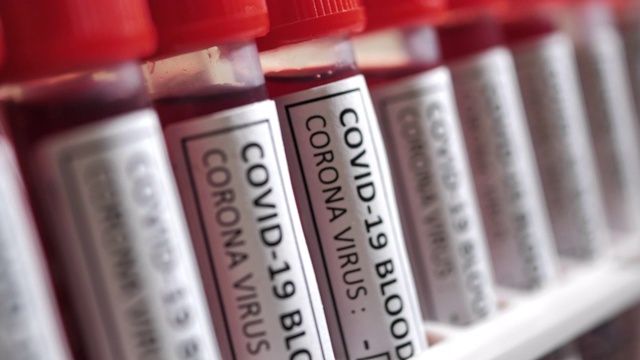 COVID-19血液试管视频素材