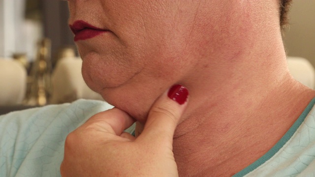 中年妇女夹着肥胖的下巴视频素材
