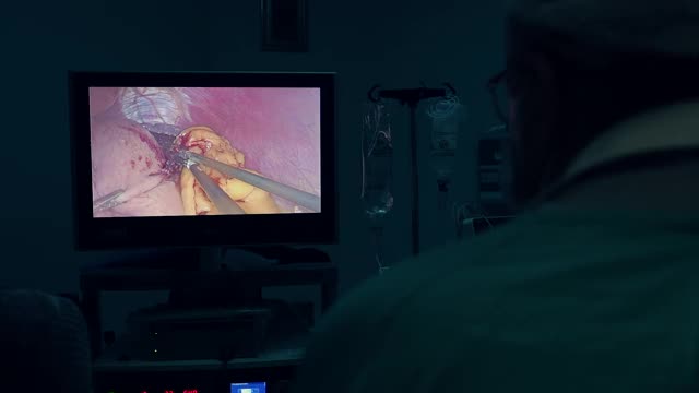 做腹腔镜手术的外科医生。腹腔镜手术在监护下进行。外科医生在手术室里做手术时，要看屏幕。现代医学技术。视频下载