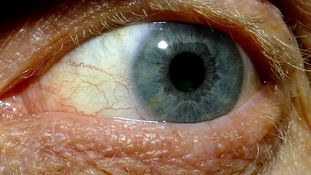 一个有红色毛细血管的老人的一只眼睛。宏视频素材