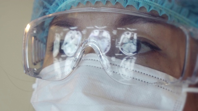 反射CT检查图像在眼镜上，医生看电脑显示器视频下载