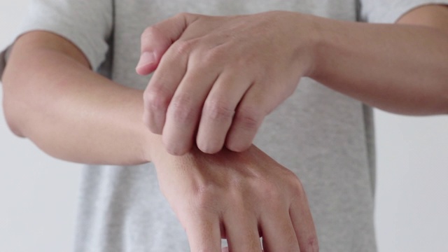 年轻的亚洲男子瘙痒和抓挠手从痒皮肤干燥湿疹皮炎视频素材