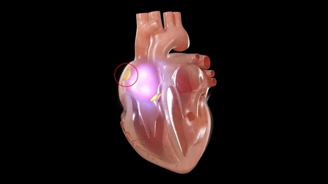 3D医疗动画-人类心脏视频下载