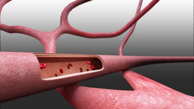 3D医学动画-血管视频下载