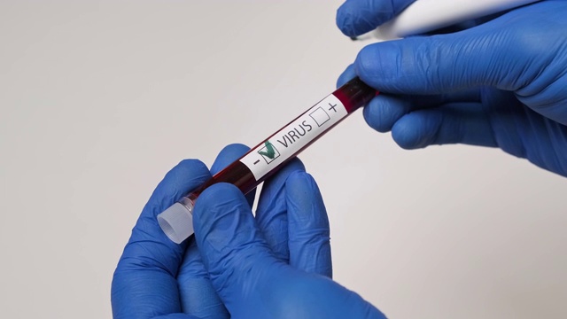 病毒检测阴性。医务人员拿着检测血样视频素材