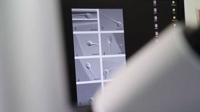 显微镜目镜视频下载