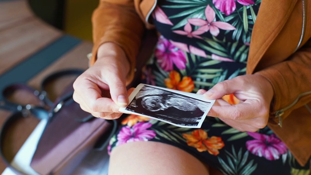 一名妇女手里拿着一张胚胎的照片。预期计划怀孕。视频素材