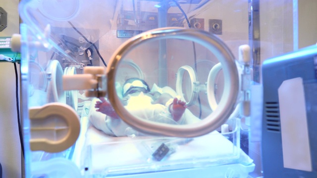 在保育箱里的漂亮新生儿在新生儿重症监护室接受黄疸治疗视频素材