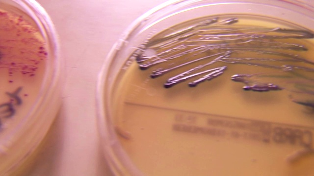 有培养皿的细菌培养物视频下载