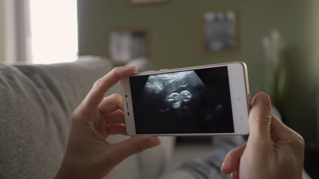 孕妇躺在家里的沙发上看智能手机上的超声波扫描。怀孕晚期妊娠。孕妇在手机上看超声波视频。妇科分娩诞生。视频素材