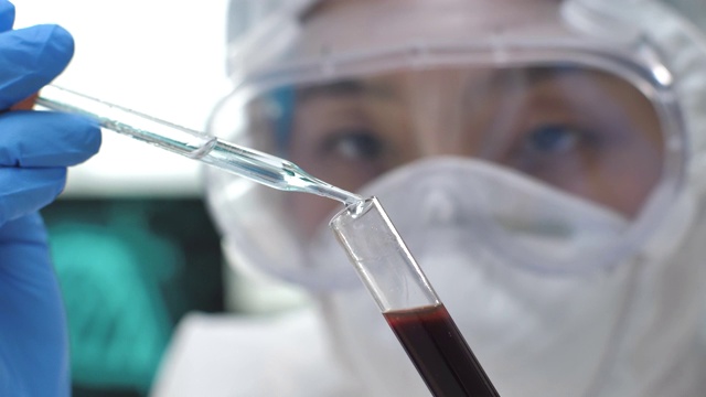 科学家在实验室将血样从移液管转移到显微镜载玻片上，冠状病毒COVID - 19检测新型冠状病毒视频素材