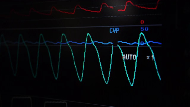 脉搏血氧测量波形视频下载