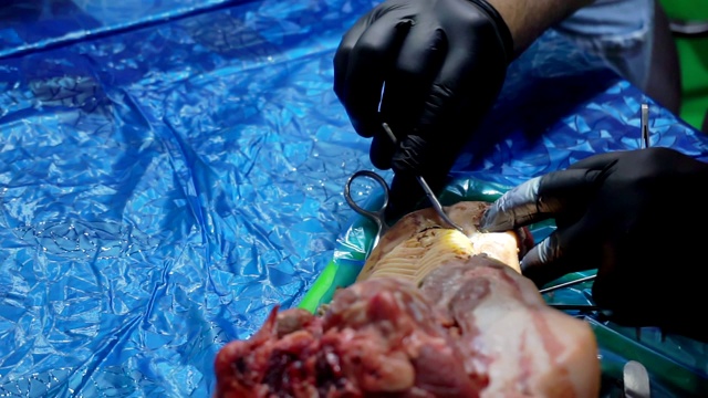 手戴手套，用手术器械解剖一块肉视频素材