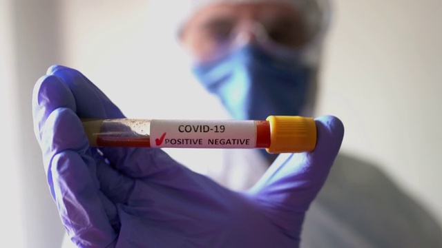 近距离观察2019冠状病毒病(COVID-19)检测呈阳性的无法辨认的病理学家视频下载