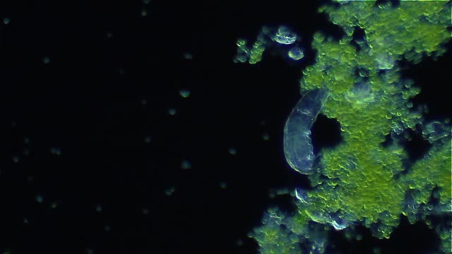 微生物-轮虫，暗视野显微镜视频下载