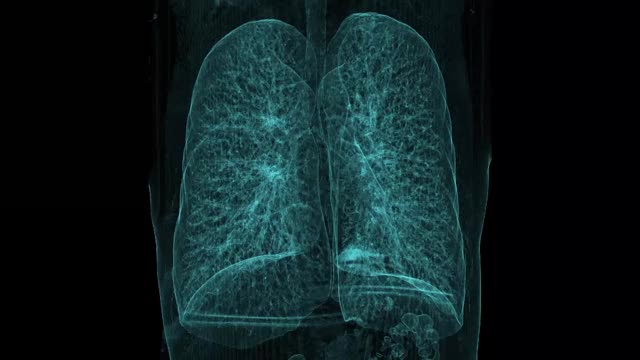 肺支气管树CT扫描视频下载